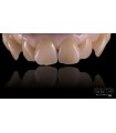 DMAX MULTILAYER SMART