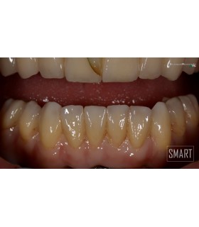 DMAX MULTILAYER SMART
