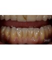 DMAX MULTILAYER SMART