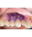 KIT PERIACRYL HV 5ML