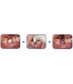 KIT PERIACRYL 10 MONODOSIS