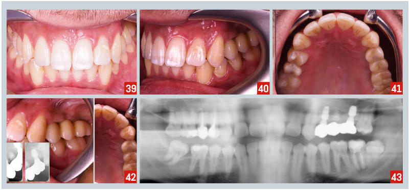 935906000016290125_zc_v1_1779795344122_c_tech5